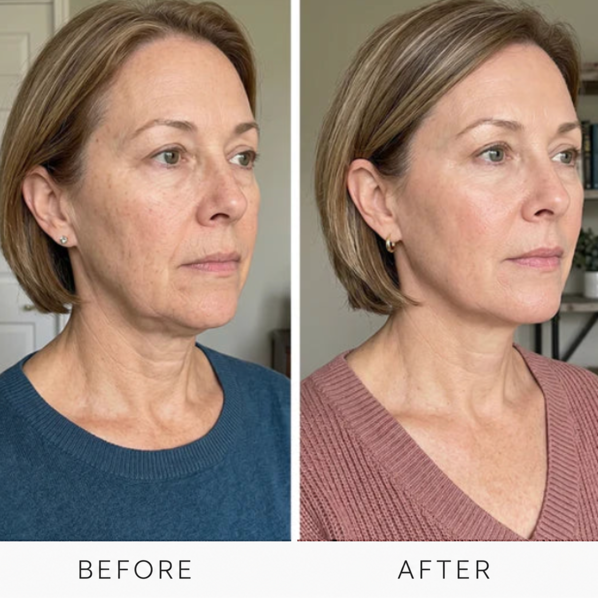 Gua sha applicator sculpting the jawline